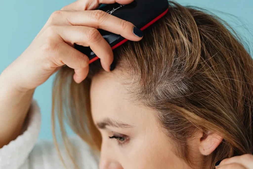 Cheveux fins crâne visible femme : vaincre & camoufler ! - woman thinning hair visible scalp