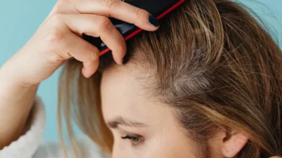 Cheveux fins crâne visible femme : vaincre & camoufler ! - woman thinning hair visible scalp
