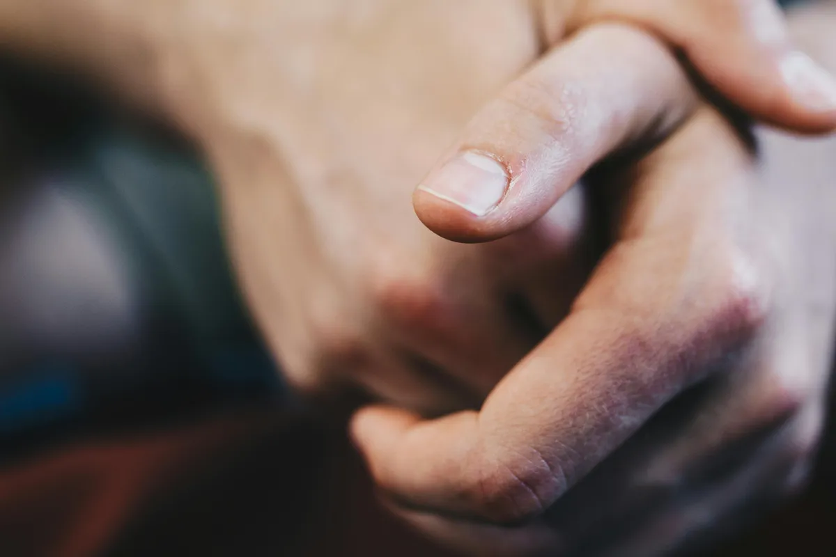 Comment coller des faux ongles sans colle ? - Nail chemical damage brittle nails skin irritation hand nail glue hazard