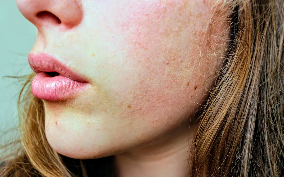 Déboucher son nez en 19 secondes : l'astuce naturelle et rapide - handkerchief nose