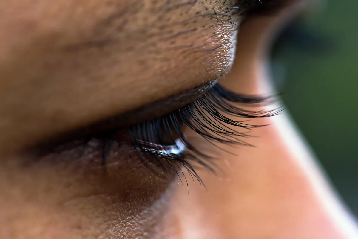 Je regrette ma blépharoplastie : 7 solutions pour agir ! - Eye eyelid exposed dry